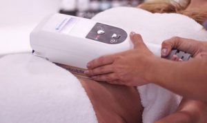coolsculpting: criolipolise no rio de janeiro
