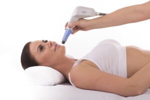 Profissional aplicando o Exilis Ultra 360 no rosto de uma paciente