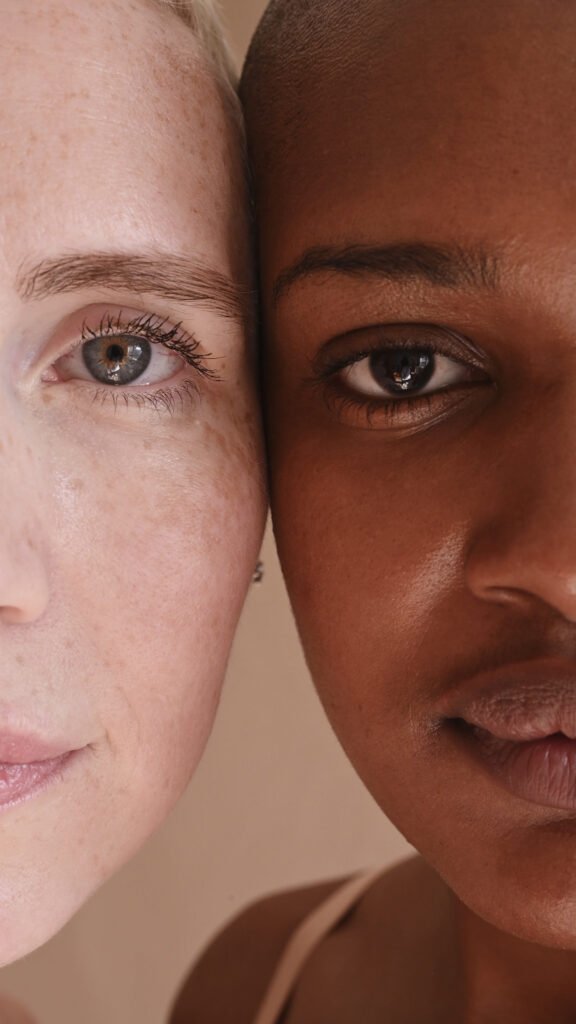  tratamentos para manchas na pele