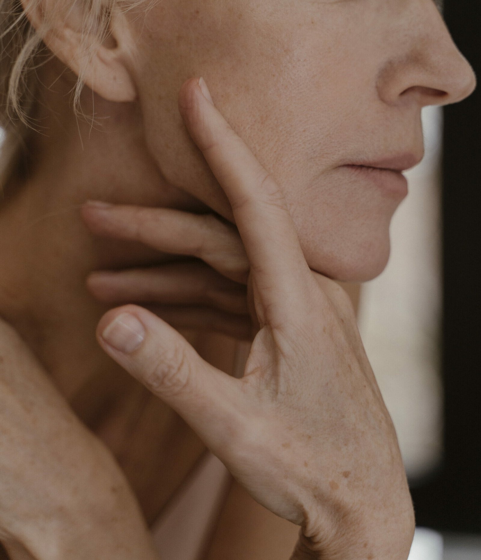 fios de sustenta&ccedil;&atilde;o Rejuvenescimento Facial